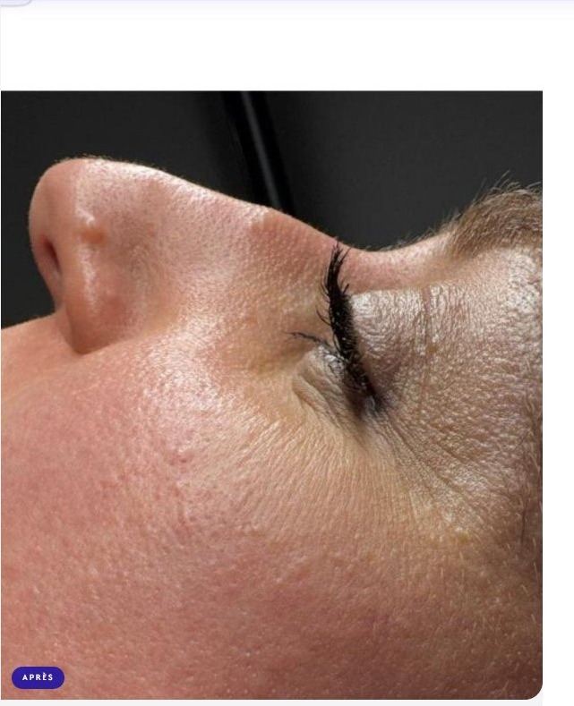 Après soin visage